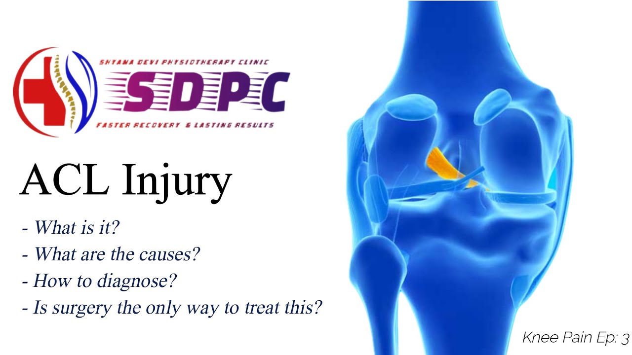 Knee Ligament Injury | ACL Knee Pain | @Dr.MaheshSahu ​| 