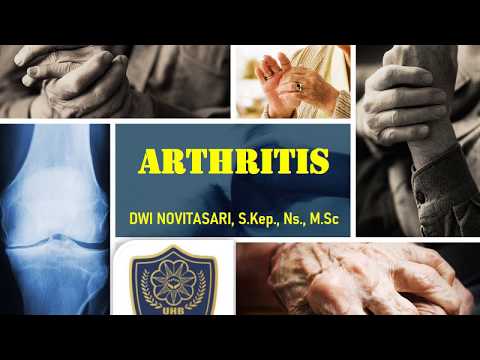 Video: Aspek Arthritis Awal. Definisi Penyakit Menyatakan Pada Arthritis Awal: Remisi Berbanding Aktiviti Penyakit Minima