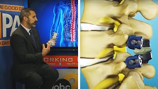 Dr. Steven M. DeLuca Interview ABC 27 Good Day PA | Premia Spine TOPS System Review