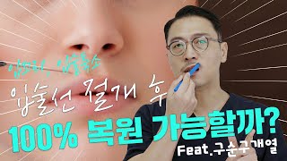 188화. 입술선, 입꼬리 절개후 100%복원가능한가요? (feat. 구순구개열)