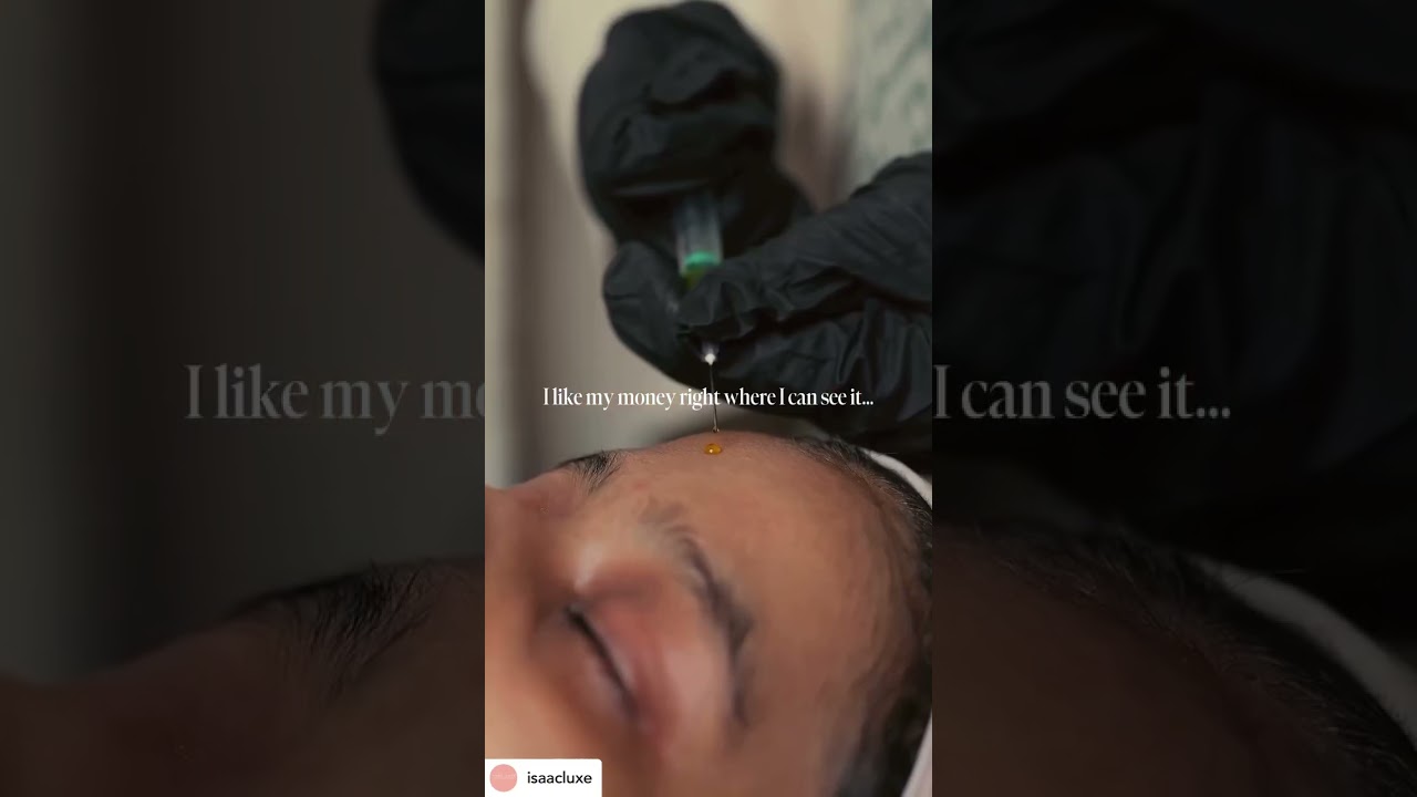 ✨ BioRePeel – The Ultimate Skin Transformation! No Downtime, Just Glow! ✨