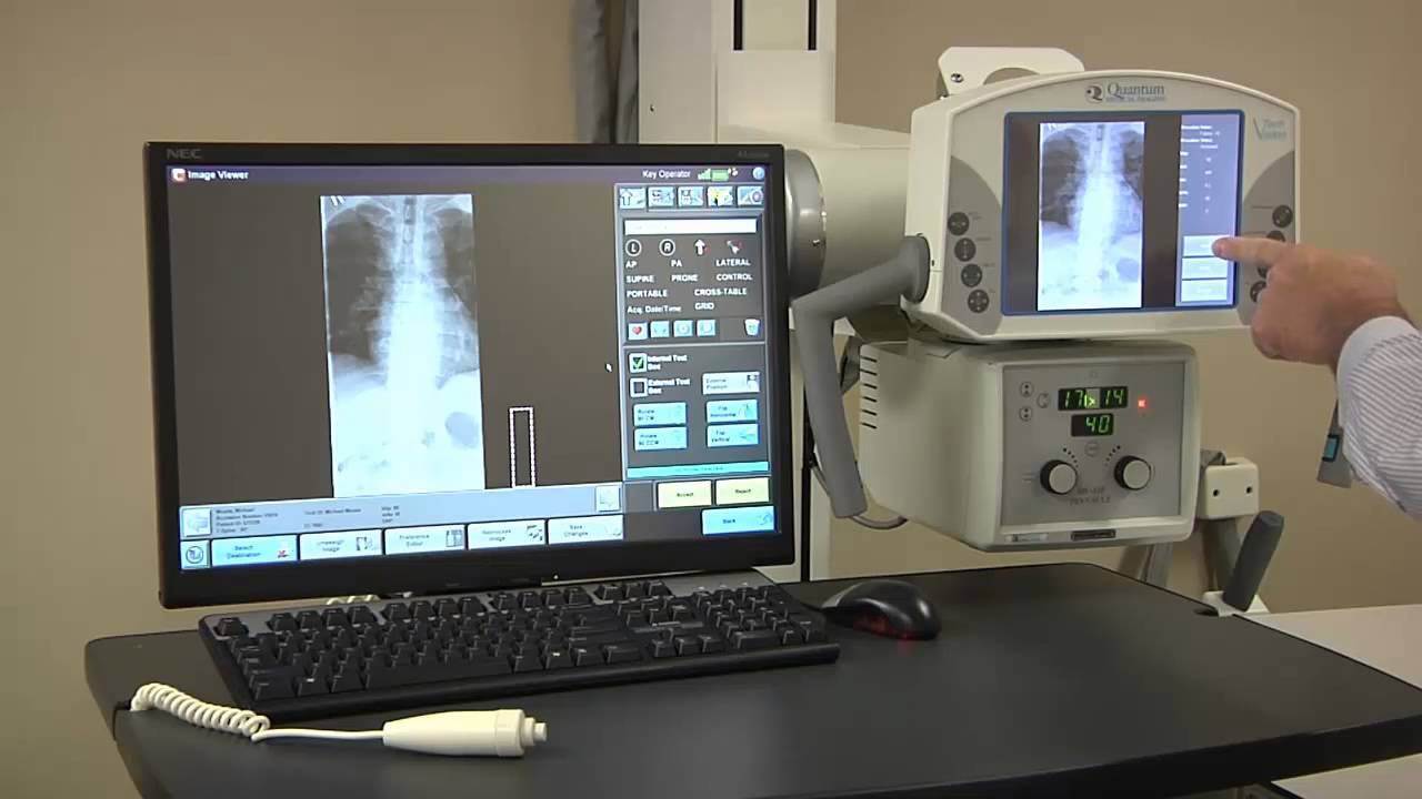 TECHVISION DRX INTEGRATION YouTube