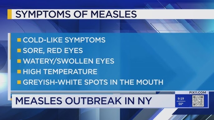 Measles Outbreak In 2024 Surpasses Number Of Cases In 2023 Cdc