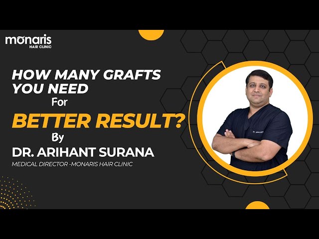 How many grafts you need for better result?