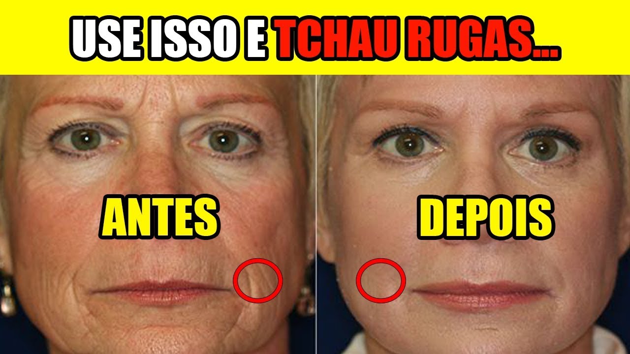 Veja Como Tirar As Rugas E Manchas No Rosto Usando Pó Royal! Como ...