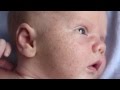 What is Baby Acne? - Boys Town Pediatrics