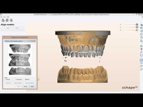 Digital Orthodontic Models Scanning