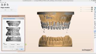 Digital Orthodontic Models Scanning