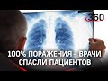 Вылечили больных со 100-процентным поражением лёгких. Врачи из Одинцова сотворили чудо