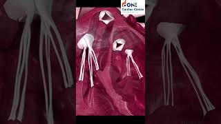 గుండెలోని "లబ్-డబ్" శబ్దం ఎలా వస్తుంది? | Science Behind Heart Sounds (Lub-Dub) | One Cardiac Centre