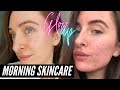 Morning Skincare Routine ACNE GLOW UP! OMG 😱  Hyram Recommended Products
