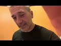 Day +1013 aml to stem cell transplant