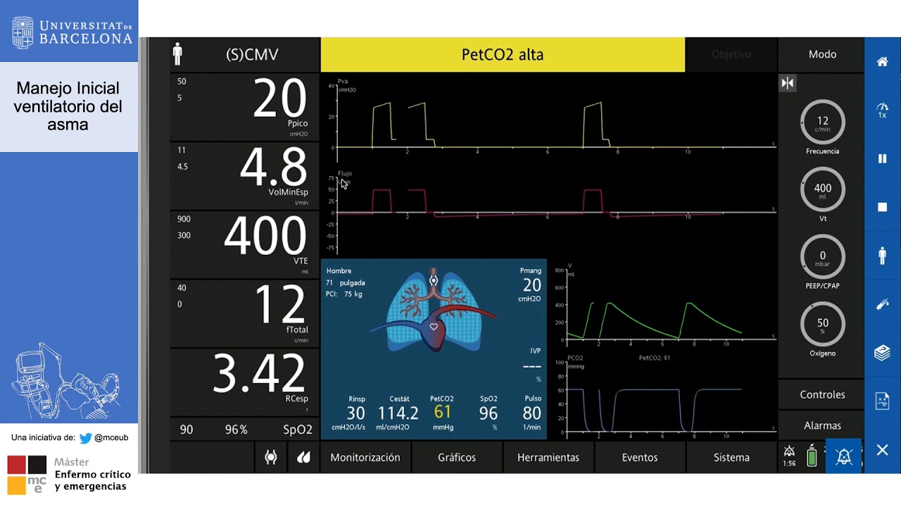 Caso Clínico: Manejo Ventilatorio Inicial del ASMA