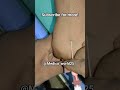 Pink cannula insertion in hand #medicoworld  #doctor #medicine #hospital #healthcare #medical