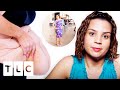 387Lb Woman Receives Weight Loss Surgery For Saving A Stranger&#39;s Life! | My Extreme Excess Skin