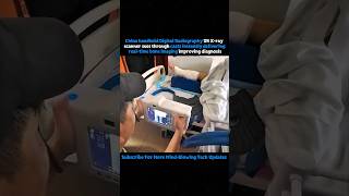 China Portable Dr X-ray Scan Bones And Deliver Response Instantly 🔥 #chinaportabledr #xrayscanner