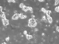 Jensen lab reprogrammed t cells vs  neuroblastoma