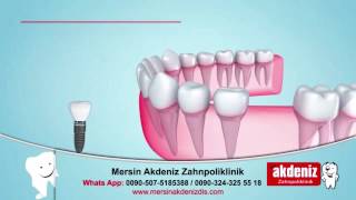 Mersin Özel Akdeniz Ağız Ve Diş Sağlığı Polikliniği