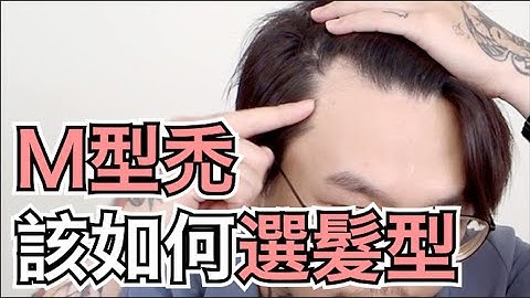 M型禿髮型選擇｜選對髮型很重要｜男生造型教學- 髮型師諾曼 - 天天要聞