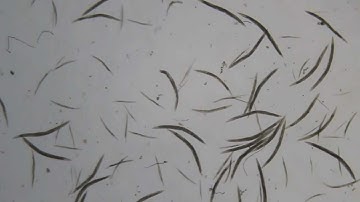 Harlem Shake worms (C. elegans)