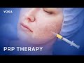 PRP Explained: The Science of Skin &amp; Hair Regeneration in 3D Animation