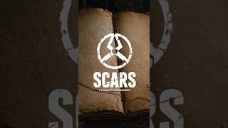 "It didn't leave." | SCARS (International Version) — A Trilogy of the UNBROKEN Chapter II