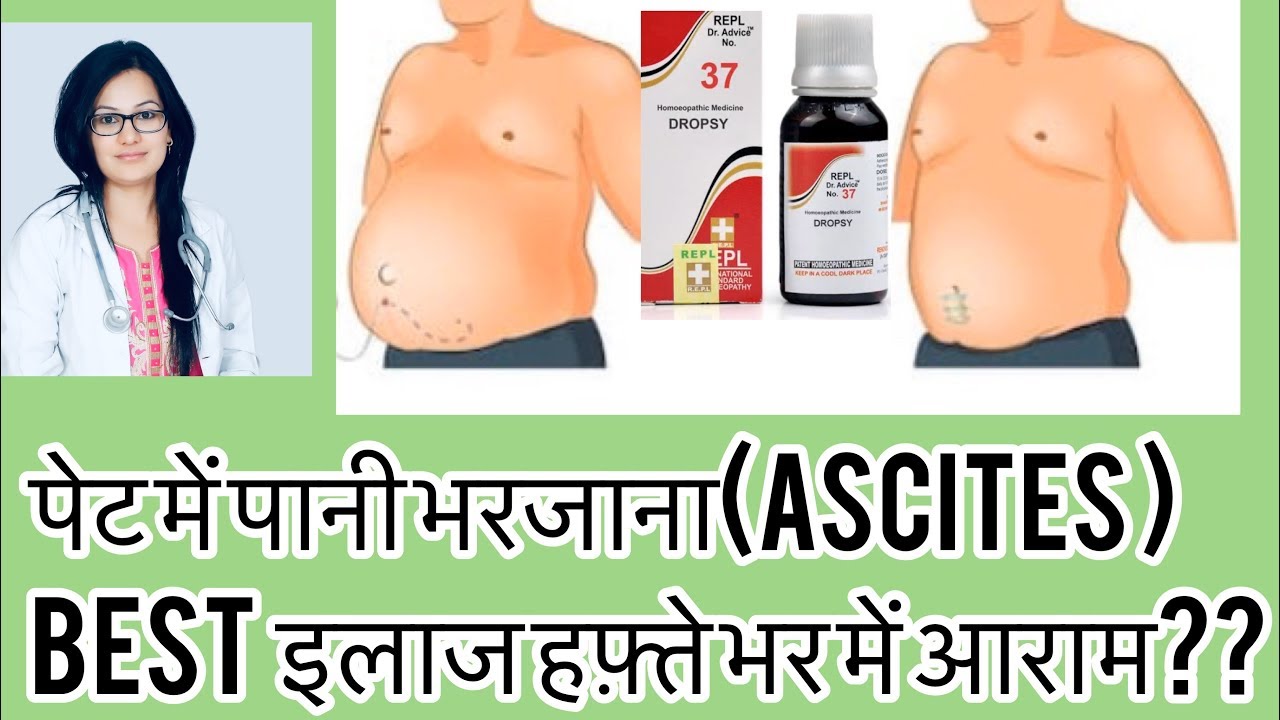 पेट मे पानी भर जाना(जलोदर)?Best Homeopathic Medicine For Ascites-By Dr rukmani Homeopathy