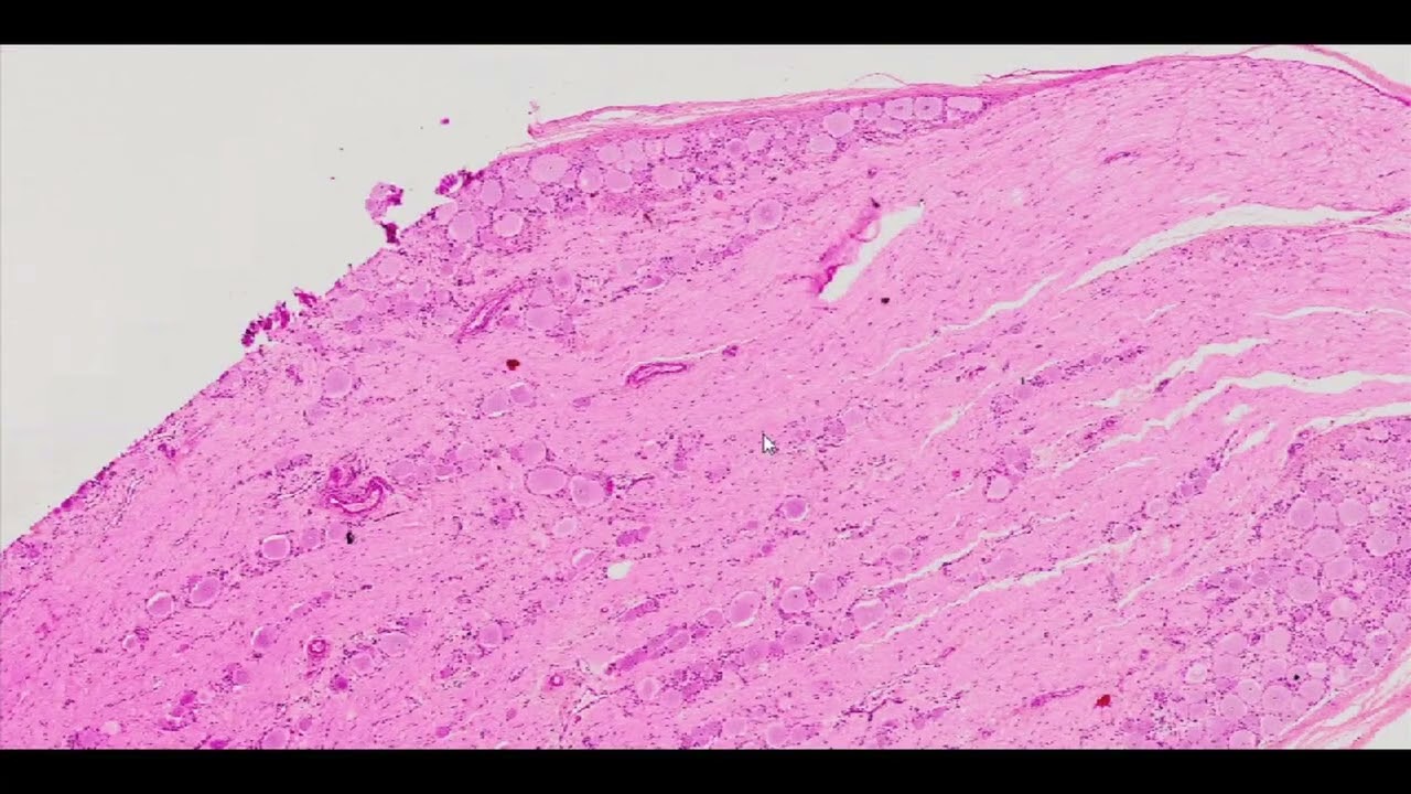 Ganglion (H&E Staining) - PUMS Histology Slides Review Series