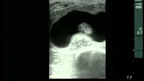 Cow #4539 Day 33 of Gestation