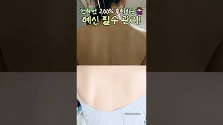 &quot;ㅇㅇㅇ&quot; 관리 안하면 진짜 후회할걸요...🔥 예신 필수 ! + 여름엔 무조건 신경쓰이는 등드름! 진짜 빠르고 쉽게 관리하는 꿀템 추천 👍🏻 #shorts #여름필수템