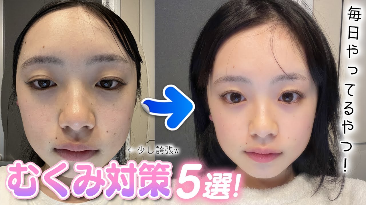 むくみ顔バイバイ！ひまひまが毎日実践してるむくみ対策5選を紹介  