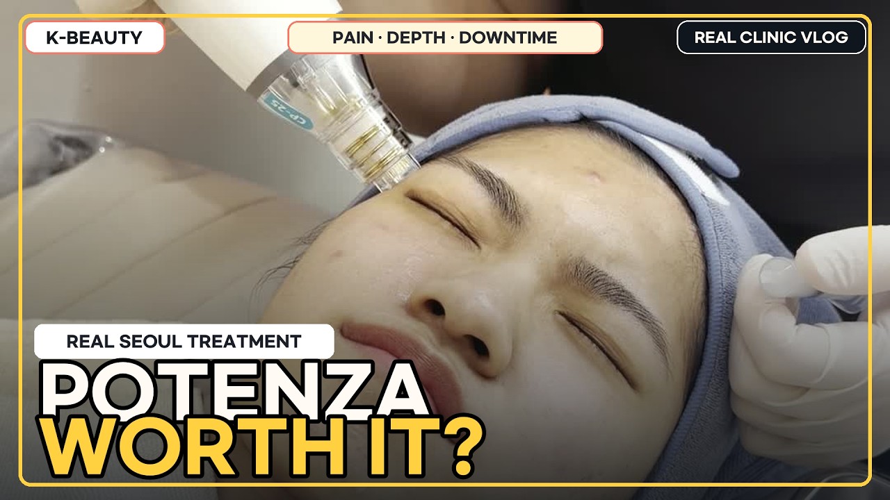 Potenza + Linear Z: Pores or Skin Laxity? | Real Seoul Treatment