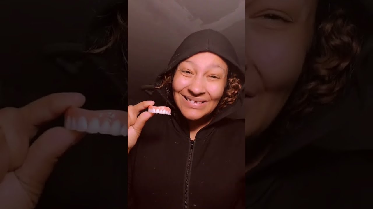  POWER What A Transformation Instant Smile Teeth Veneers 2025