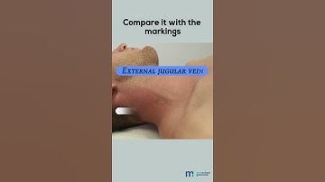 Examination of Jugular Venous Pulse