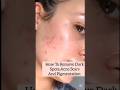 "Masoor Dal for Pigmentation | Natural Remedy for Glowing Skin!"#mycozydunia