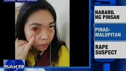 Saksi: Babaeng OFW sa Saudi Arabia, halos mabulag nang gulpihin umano ng amo