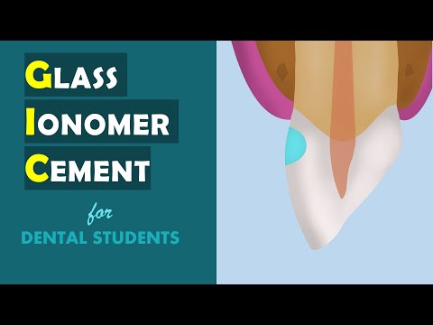 Glass Ionomer Cement