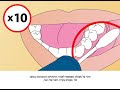 ORAcollect.DNA (OCR-100) collection instructions (Hebrew)