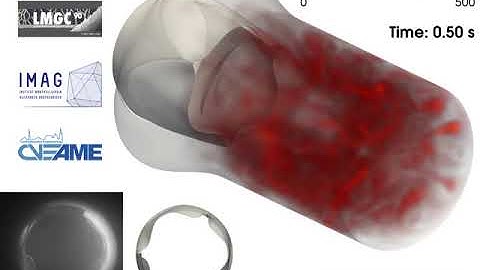 3D unsteady FSI computation of the hemodynamics through a model of aortic valve