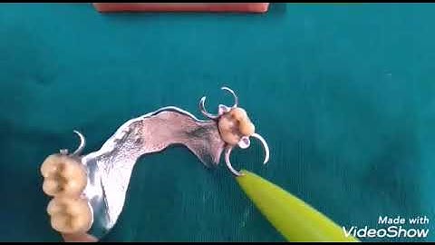 Parts Of Removable Partial Denture