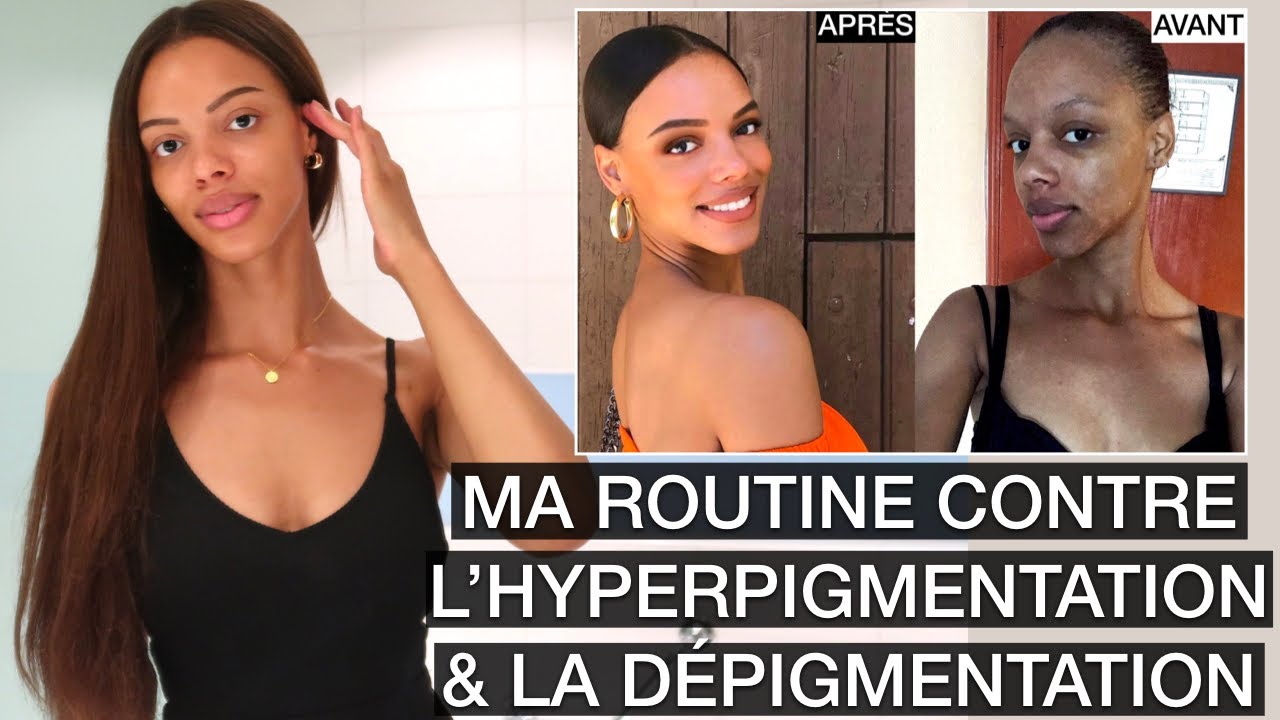 MA ROUTINE CONTRE L' HYPER/DÉPIGMENTATION | Pour Un Teint Uniforme & Sans Taches