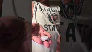 Removing my Dexcom sensor!!!