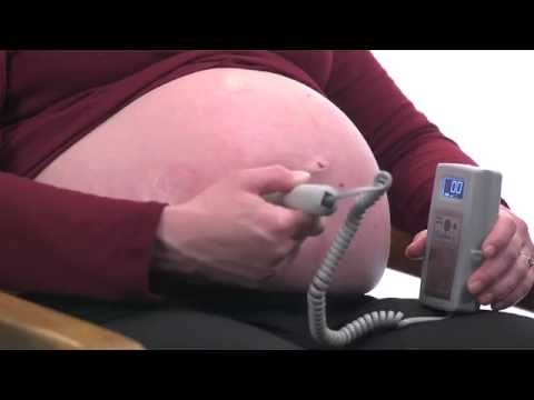 BabyBeat - Fetal Heart Sounds Using the