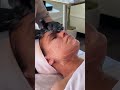 Microneedling With Hyaluronic Infusion   #facial