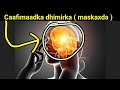Caafimaadka Dhimirka Maskaxda 8 Daan Sheey Ku Dadaal вќЈпёЏвњ Caafimaadka Dhimirka Maskaxda 8 Daan Sheey Ku Dadaal вќЈпёЏвњ