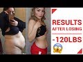 MY IMPERFECTIONS AFTER -120lbs WEIGHT LOSS (MUST WATCH!!!)