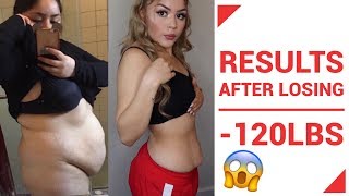 MY IMPERFECTIONS AFTER -120lbs WEIGHT LOSS (MUST WATCH!!!)