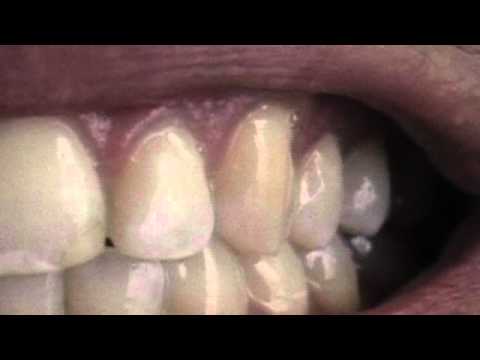 teeth