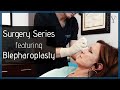 Blepharoplasty  atlanta eyelid surgery  y plastic surgery