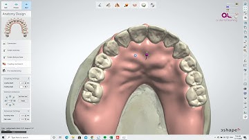 Digital Denture Workflow Teaser 2021